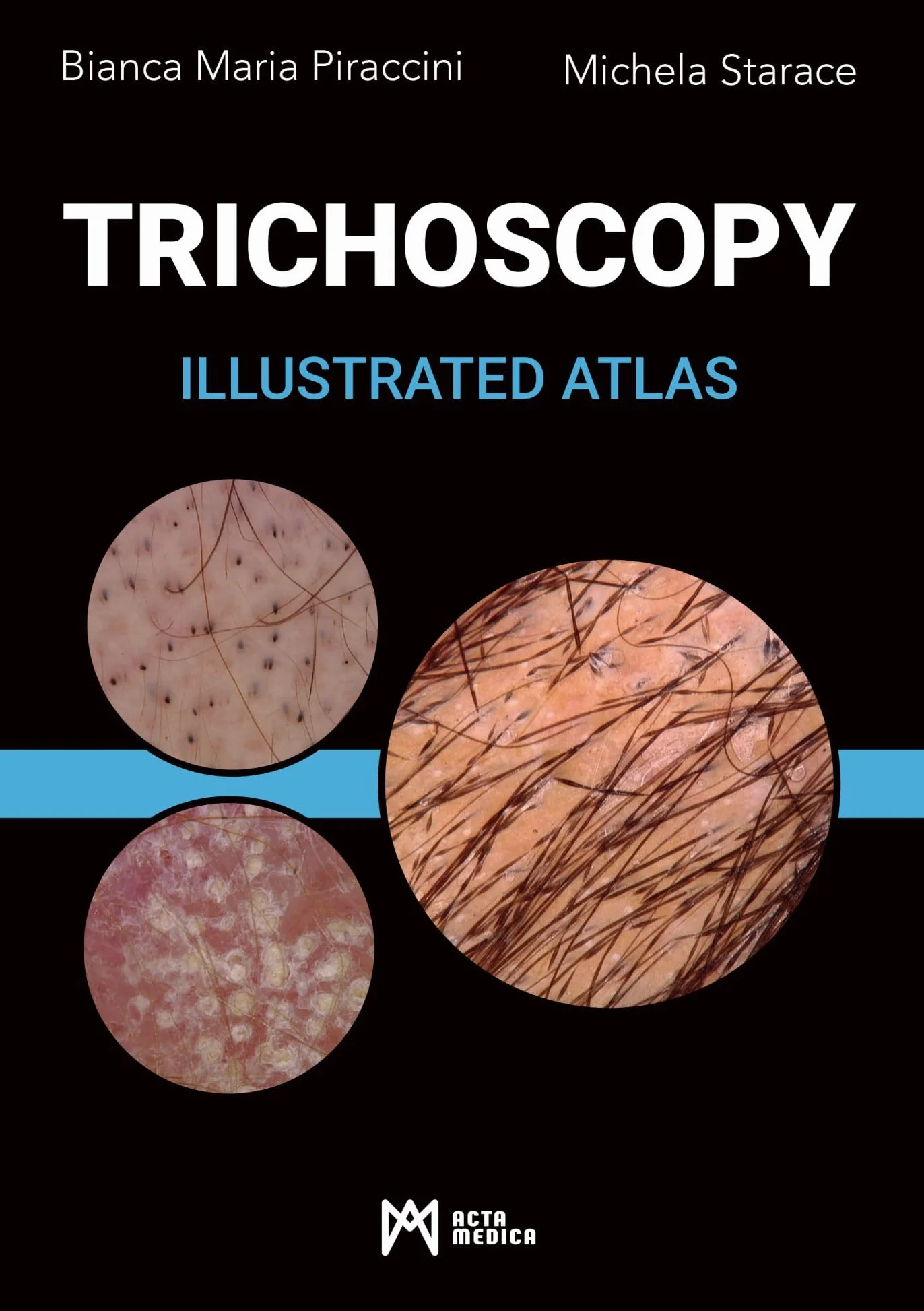 Trichoscopy. Illustrated atlas