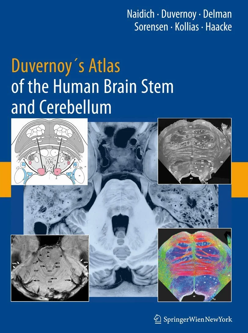 Duvernoy's Atlas of the Human Brain Stem and Cerebellum: High-Field MRI, Surface Anatomy, Internal Structure, Vascularization and 3 D Sectional Anatomy