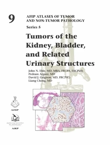 Tumors of the Kidney, Bladder, and Related Urinary Structures: 9