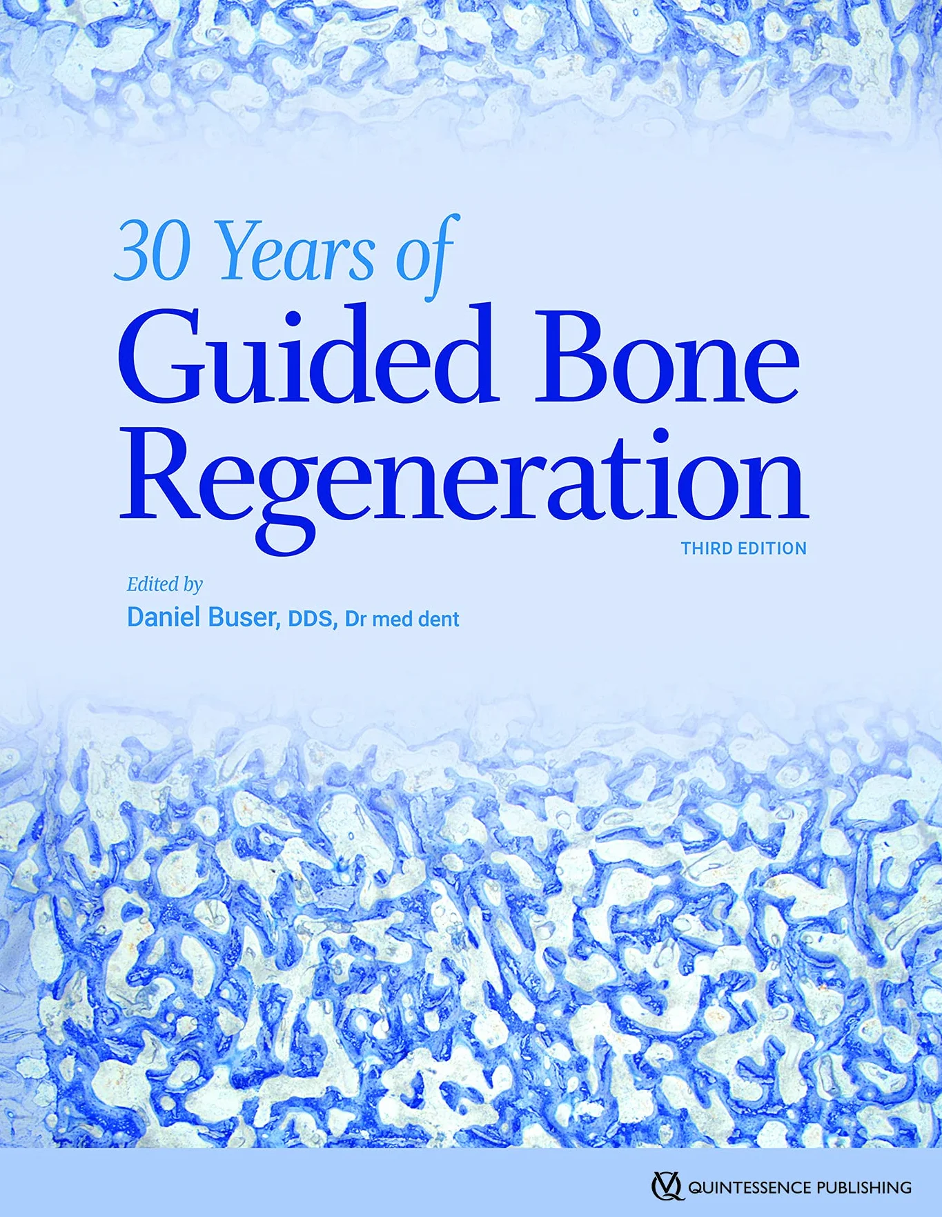 30 Years of Guided Bone Regeneration