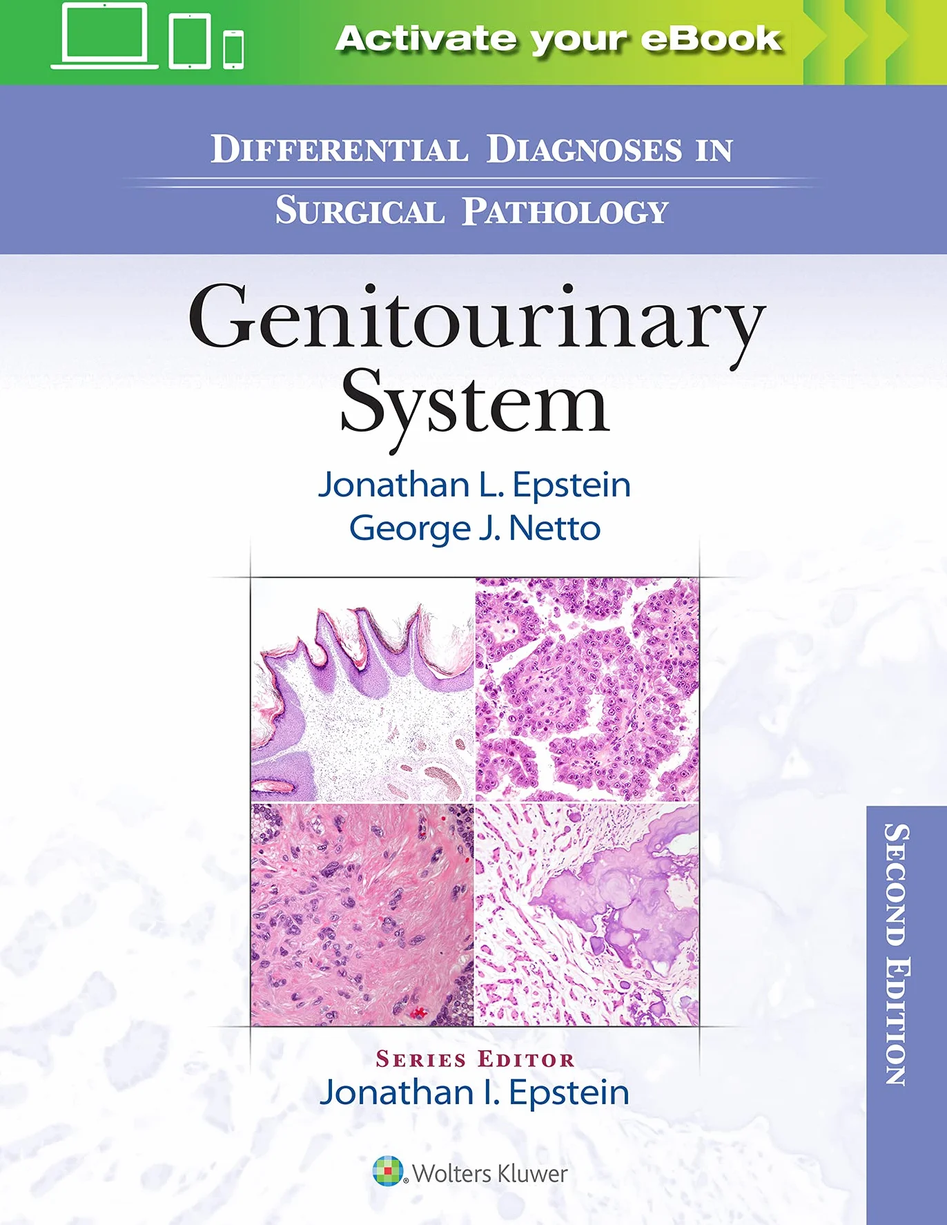 Differential Diagnoses in Surgical Pathology: Genitourinary System
