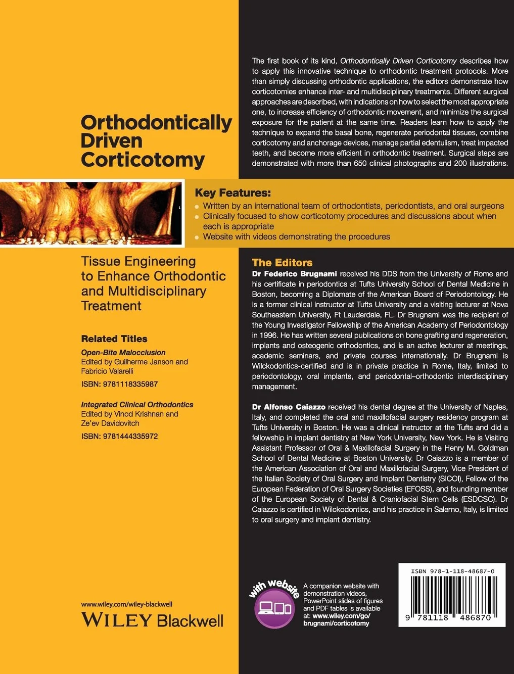Orthodontically Driven Corticotomy: Tissue Engineering to Enhance Orthodontic and Multidisciplinary Treatment