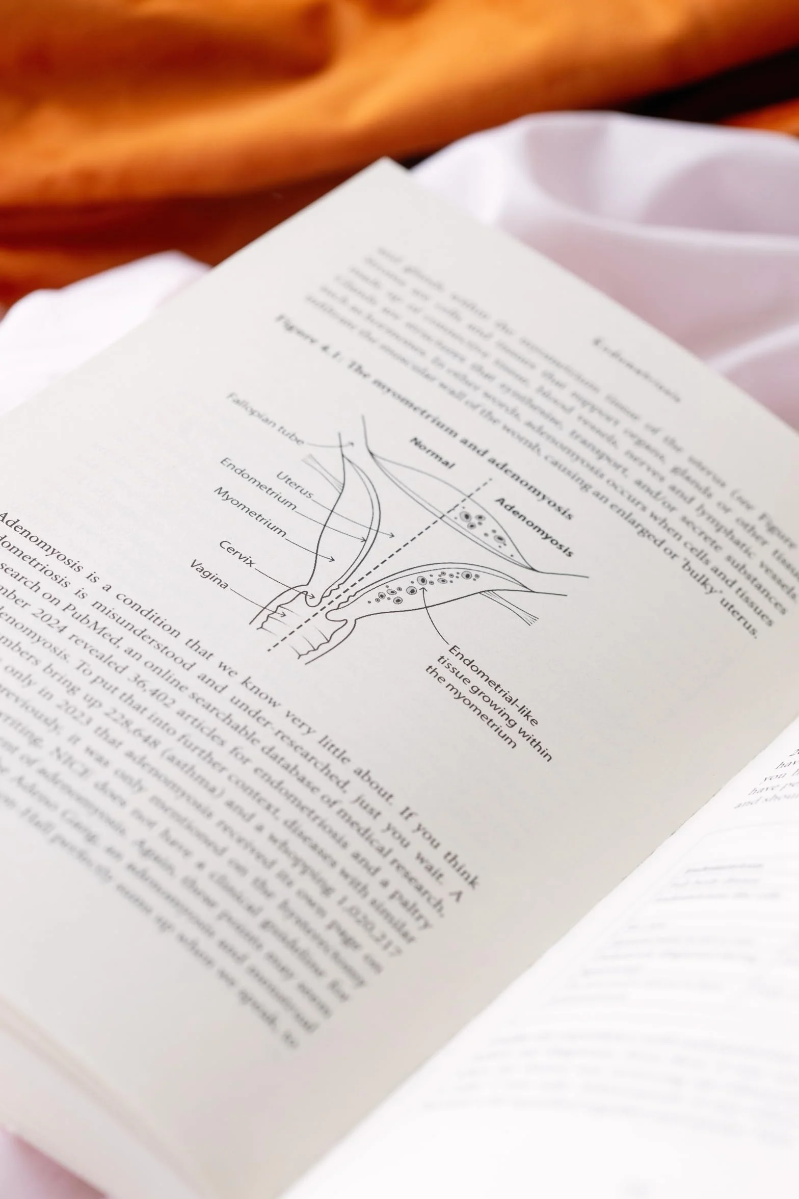Endometriosis: Understand your symptoms, get the right treatment, reclaim your life